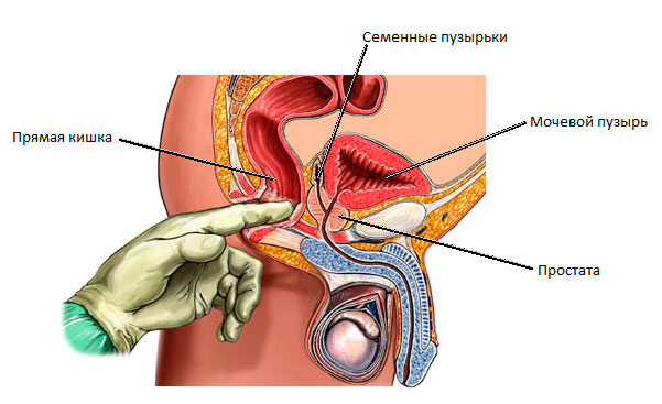 Аденома простаты и секс