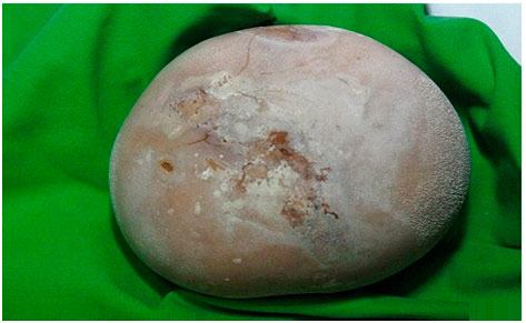 Фото и описание видов камней в почках - Uclinica в Москве