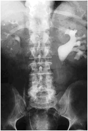 Обзорный рентгеновский снимок